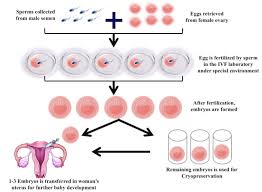 Embryo freezing process diagram in IVF treatment