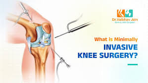 Minimally invasive joint surgery