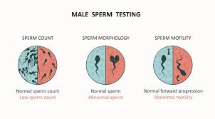 Male sperm testing graphic for infertility assessment