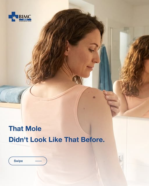 Changes in an existing mole, including shape, colour, size, border, bleeding, itching, or crusting, deserve attention. Not every change is…