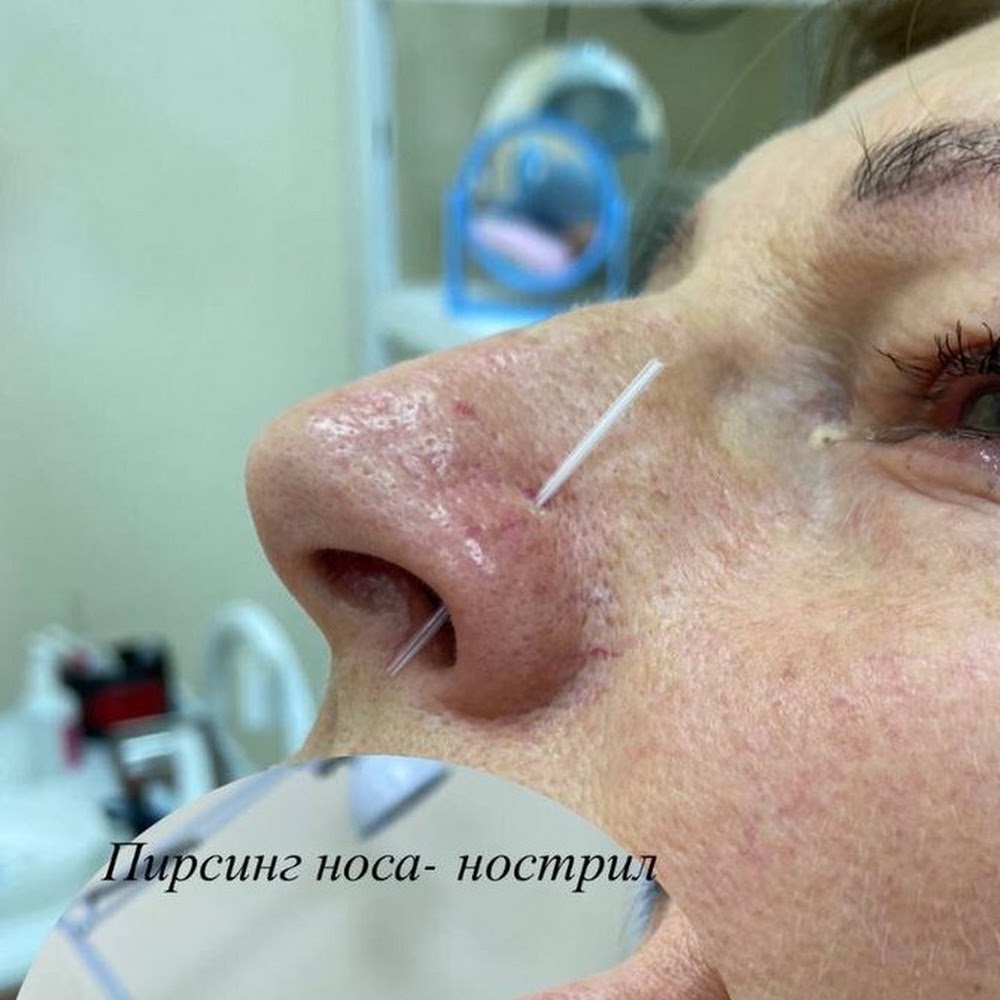Сопрано Косметология, дерматология, лазерная эпиляция, чистка лица Волгоград